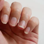 längsrillen fingernägel leber