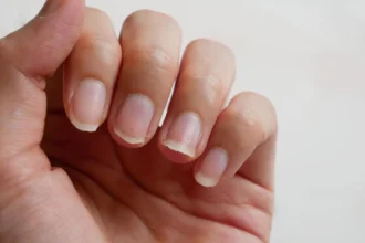 längsrillen fingernägel leber